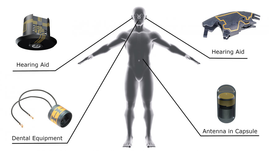 La technologie 3D-MID permet de développer des solutions moins invasives pour ausculter les patients